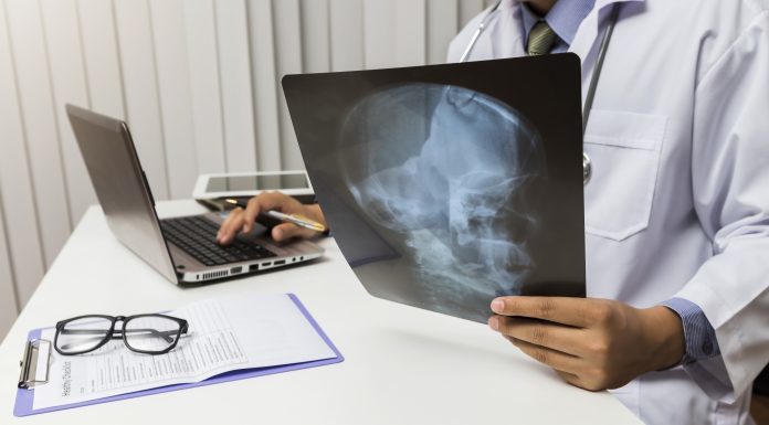 โรคมะเร็งสมองกัน เกิดจากอะไร รักษาอย่างไร